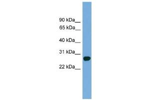 WB Suggested Anti-Abt1 Antibody Titration: 0. (Activator of Basal Transcription 1 anticorps  (C-Term))