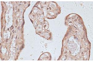 Immunohistochemistry of paraffin-embedded Human placenta using TLK1 Polyclonal Antibody at dilution of 1:100 (40x lens).
