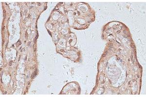Immunohistochemistry of paraffin-embedded Human placenta using TLK1 Polyclonal Antibody at dilution of 1:100 (40x lens). (TLK1 anticorps)