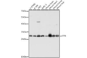 Western blot analysis of extracts of various cell lines, using ETFB antibody (ABIN7266916) at 1:1000 dilution. (ETFB anticorps  (AA 80-230))