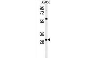 Western Blotting (WB) image for anti-Glutathione S-Transferase omega 2 (GSTO2) antibody (ABIN3002458)