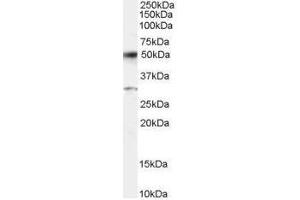 Image no. 1 for anti-Activating Transcription Factor 2 (ATF2) (C-Term) antibody (ABIN374122) (ATF2 anticorps  (C-Term))