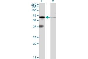 Western Blotting (WB) image for anti-Eukaryotic Translation Initiation Factor 2-alpha Kinase 2 (EIF2AK2) (AA 1-101) antibody (ABIN598901) (EIF2AK2 anticorps  (AA 1-101))