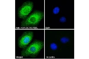 ABIN185208 Immunofluorescence analysis of paraformaldehyde fixed A549 cells, permeabilized with 0.