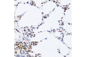 Immunohistochemistry of paraffin-embedded rat lung using NFKB2 Antibody.