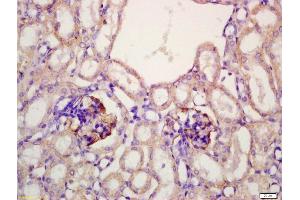 Formalin-fixed and paraffin embedded mouse kidney labeled with Anti-Megalin Polyclonal Antibody, Unconjugated (ABIN750988) at 1:200 followed by conjugation to the secondary antibody and DAB staining (LRP2 anticorps  (AA 3401-3500))