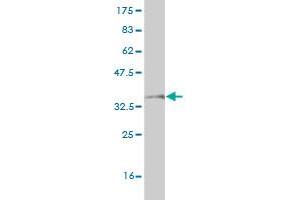 Western Blot detection against Immunogen (37.