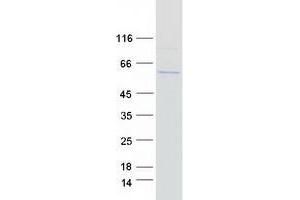 Validation with Western Blot