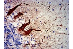Immunohistochemical analysis of paraffin-embedded human cerebellum tissues using NEFH mouse mAb with DAB staining. (NEFH anticorps  (AA 2-251))