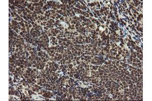 Image no. 1 for anti-Proline Synthetase Co-Transcribed (PROSC) antibody (ABIN1500440)