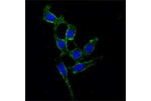 Immunofluorescence analysis of A549 cells using FAK mouse mAb (green). (FAK anticorps)