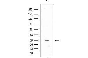 Western blot analysis of lysates from EC304 cells, using FOLR3 Mouse Monoclonal Antibody at 1/1000 dilution.