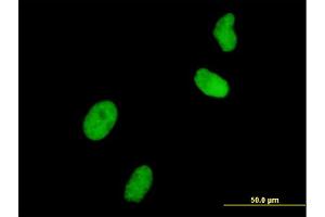 Immunofluorescence of monoclonal antibody to UHRF1 on HeLa cell. (UHRF1 anticorps  (AA 694-793))