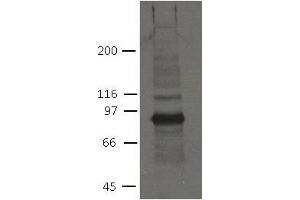 Image no. 1 for anti-Plakophilin 2 (PKP2) (AA 1-350) antibody (ABIN1169700)