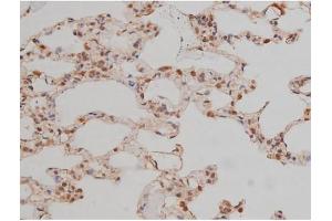 ABIN6267334 at 1/200 staining Rat lung tissue sections by IHC-P. (SP1 anticorps  (pThr739))