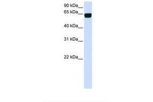 Image no. 1 for anti-Phosphatidylinositol Glycan T (PIGT) (AA 434-483) antibody (ABIN6738311) (PIGT anticorps  (AA 434-483))