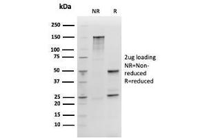 SDS-PAGE Analysis SOX2 Recombinant Mouse Monoclonal Antibody (rSOX2/1792).