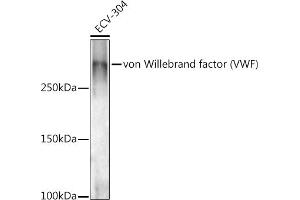 Western blot analysis of extracts of ECV-304 cells, using von Willebrand factor (VWF) antibody (ABIN3015449, ABIN3015450, ABIN5663874 and ABIN6217310) at 1:1000 dilution. (VWF anticorps  (AA 50-150))