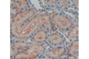 Used in DAB staining on fromalin fixed paraffin- embedded kidney tissue