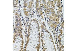 Immunohistochemistry of paraffin-embedded human stomach using PDCD6IP antibody (ABIN1874065) at dilution of 1:100 (40x lens). (ALIX anticorps)
