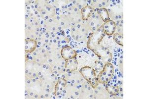 Immunohistochemistry of paraffin-embedded mouse kidney using MTERFD3 antibody. (MTERFD3 anticorps  (AA 1-250))