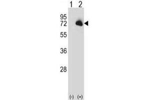 Western blot analysis of BTK antibody and 293 cell lysate (2 ug/lane) either nontransfected (Lane 1) or transiently transfected (2) with the BTK gene.