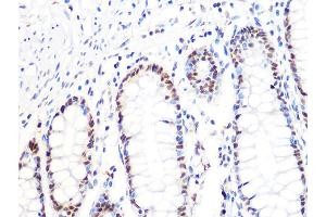 Immunohistochemistry of paraffin-embedded human colon using DKC1 Rabbit mAb (ABIN7266869) at dilution of 1:100 (40x lens). (DKC1 anticorps)