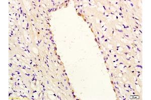 Formalin-fixed and paraffin embedded rabbit carotid artery labeled with Anti-IL-8/CXCL8 Polyclonal Antibody, Unconjugated (ABIN728053) at 1:200, followed by conjugation to the secondary antibody and DAB staining (IL-8 anticorps  (AA 31-99))