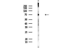 anti-Fatty Acid Transport Protein 1 (FATP1) (Internal Region) antibody