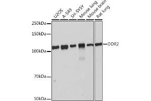 Western blot analysis of extracts of various cell lines, using DDR2 Rabbit mAb (ABIN7266790) at 1:1000 dilution. (DDR2 anticorps)