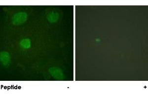 Immunofluorescence analysis of HeLa cells, treated with TNF-a (20 nM, 15 mins), using TGFB1I1 polyclonal antibody . (TGFB1I1 anticorps)