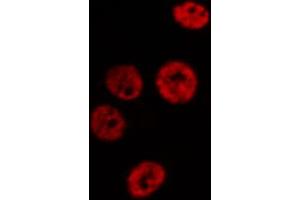 ABIN6266586 staining HeLa cells by IF/ICC.