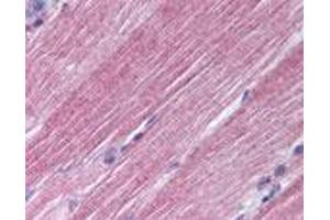 anti-RAB7A, Member RAS Oncogene Family (RAB7A) antibody