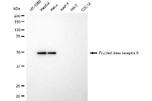 Western blotting analysis using frizzled class receptor 9 antibody (ABIN7798661).
