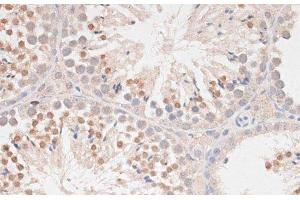 Immunohistochemistry of paraffin-embedded Mouse testis using MAD2L1 Polyclonal Antibody at dilution of 1:100 (40x lens). (MAD2L1 anticorps)