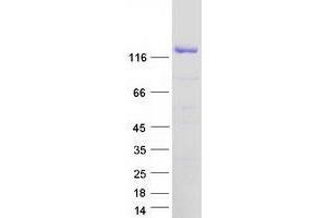 Validation with Western Blot