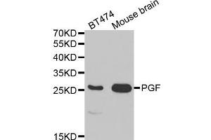 Western blot analysis of extracts of various cell lines, using PGF antibody (ABIN5970864) at 1/1000 dilution. (PLGF anticorps)