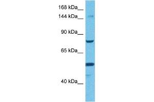 Host:  Rabbit  Target Name:  TMEM2  Sample Tissue:  Human HCT15 Whole Cell  Antibody Dilution:  1ug/ml (TMEM2 anticorps  (Middle Region))
