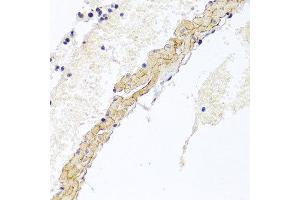 Immunohistochemistry of paraffin-embedded mouse lung using CD81 antibody at dilution of 1:100 (x40 lens). (CD81 anticorps)