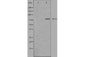 Western blot analysis of extracts from HUVEC cells, using NOL10 antibody. (NOL10 anticorps  (C-Term))