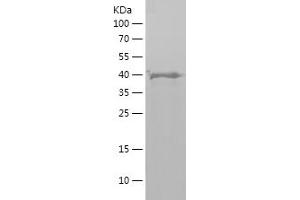 Western Blotting (WB) image for Parkinson Protein 2, E3 Ubiquitin Protein Ligase (Parkin) (PARK2) (AA 1-165) protein (His-IF2DI Tag) (ABIN7124320)