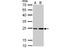 WB Image H-Ras antibody detects HRAS protein by Western blot analysis. (HRAS anticorps  (C-Term))