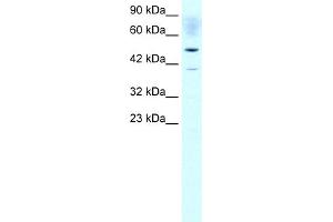 WB Suggested Anti-ACAT2 Antibody Titration:  1. (ACAT2 anticorps  (Middle Region))