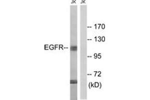 Western blot analysis of extracts from Jurkat cells, treated with UV 15', using EGFR (Ab-998) Antibody. (EGFR anticorps  (AA 966-1015))