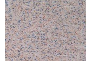 Figure. (Kallikrein 2 anticorps  (AA 19-261))