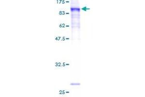 Image no. 1 for Prickle Homolog 3 (PRICKLE3) (AA 1-615) protein (GST tag) (ABIN1316198)