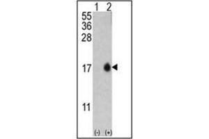 Western blot analysis of MAP1LC3B (arrow) using LC3B Antibody (T6) in Y79 cell line lysates and mouse brain tissue lysates (35 µg/lane). (LC3B anticorps  (N-Term))