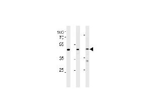 NROB1 Antibody (N-term) (ABIN389157 and ABIN2839323) western blot analysis in Hela,NCI-,PC-3 cell line lysates (35 μg/lane). (NR0B1 anticorps  (N-Term))