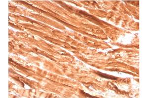 Formalin-fixed, paraffin-embedded human Skeletal Muscle stained with Dystrophin Monospecific Mouse Monoclonal Antibody (DMD/3242). (Dystrophin anticorps  (AA 114-263))