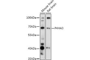 Western blot analysis of extracts of various cell lines, using P4H antibody (ABIN6132886, ABIN6145137, ABIN6145138 and ABIN6217878) at 1:3000 dilution. (P4HA3 anticorps  (AA 20-110))